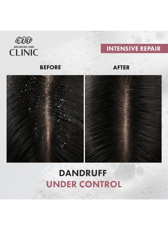 Clinic Intensive Repair Anti-dandruff Shampoo with Keratin & Tea Tree Oil for Damaged Hair 230ml (٤)
