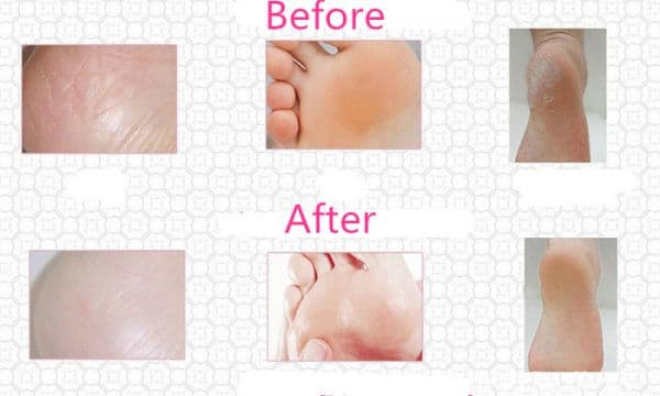 Moisturising Gel Socks Soaps (٣)