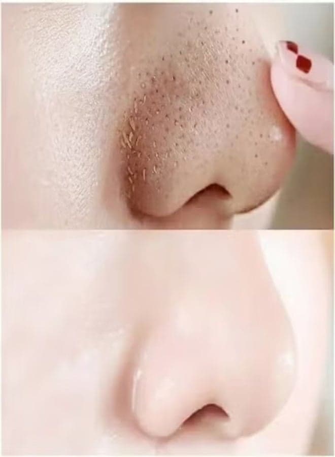 Ce-Tua Nose Pore Strips With Carbon - 3 Strips Blackhead Remover Nose Strips (٤)