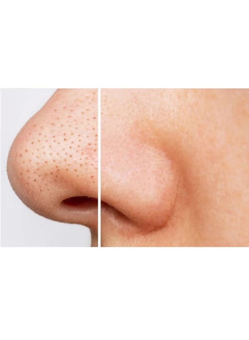 Ce-Tua Nose Pore Strips - 3 Strips Blackhead Remover Nose Strips (٢)