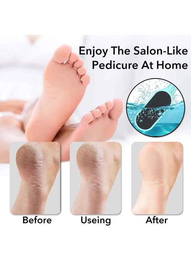 Foot File for Removing Dead Skin and Cracked Heels – Foot Care Tool with Ergonomic Handle, Reusable – Callus Remover for Men & Women – Perfect Pedicure Tools for Foot Scrubbing (Random Color) (5)