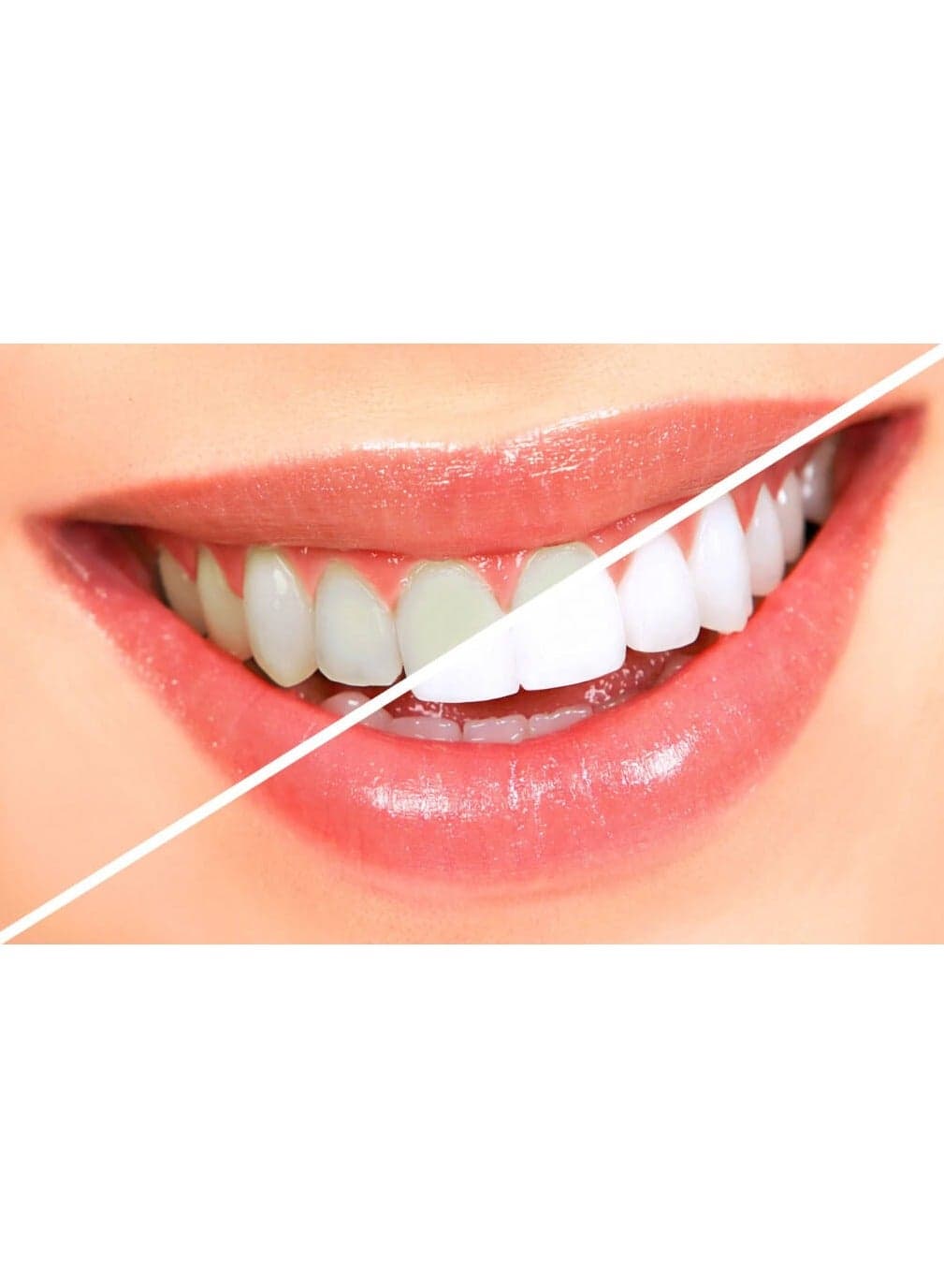 Smokers Tooth Powder With Charcoal- 40 Gm Teeth Whitening (2)