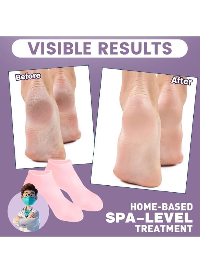 Moisturizing Gel Silicone Socks for Women – Intensive Foot Care for Dry Cracked Feet – Infused with Vitamin E, Jojoba Oil, Olive Oil, Rose Oil – Softening and Healing Cracked Heels – Spa Quality At-Home Foot Care Socks – Reusable Silicone Socks for Women – Self-Care Gift for Mom, Perfect for Mothers Day and Home Spa Treatments – Elastic Size Fits Most Adult Feet (٥)